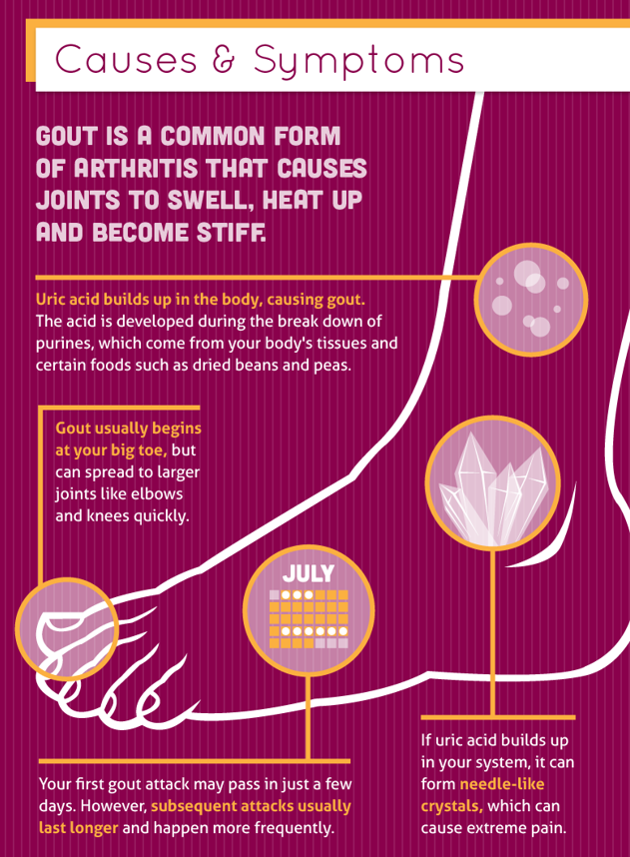 Gout is a common form of arthritis that usually causes pain in the big toe.