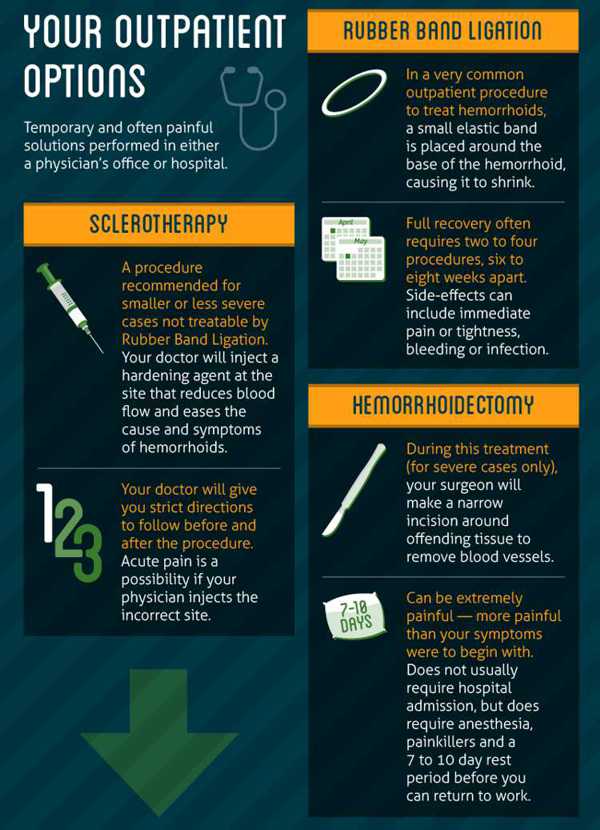 Hemorrhoids surgery options.